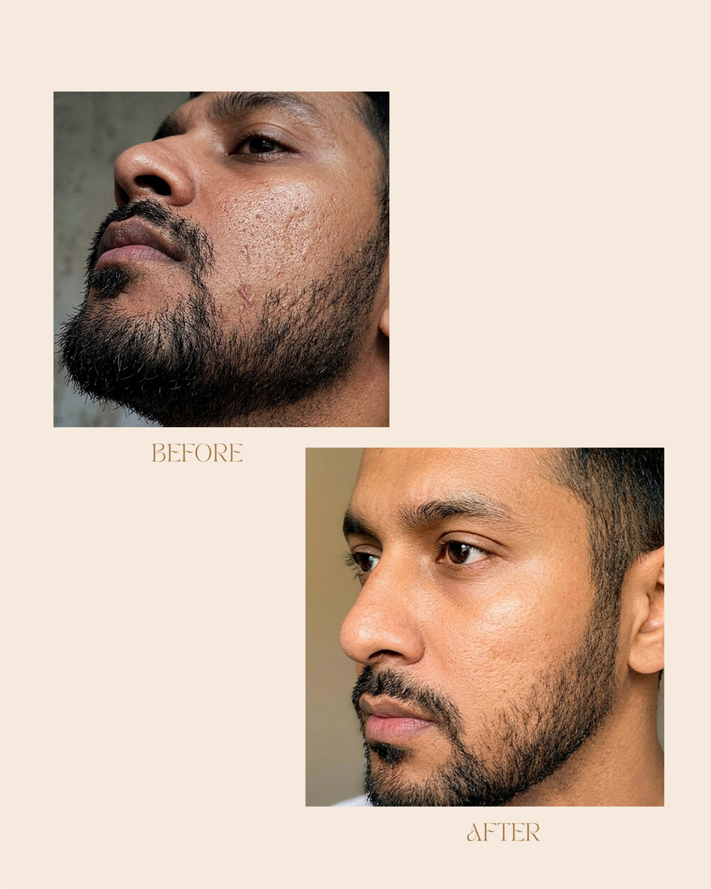 GLOW RADIANT PLUS